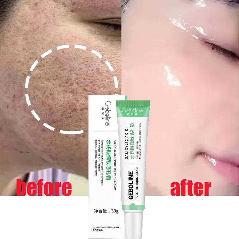 Collagen Peptide Powder - Salicylzuur Porie Krimpende Crème Snelle Eliminatie