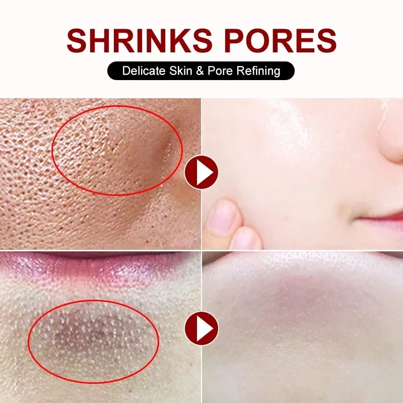 Salicylzuur Porie Krimpende Cr - Collagen Peptide Powder recensie en prijs