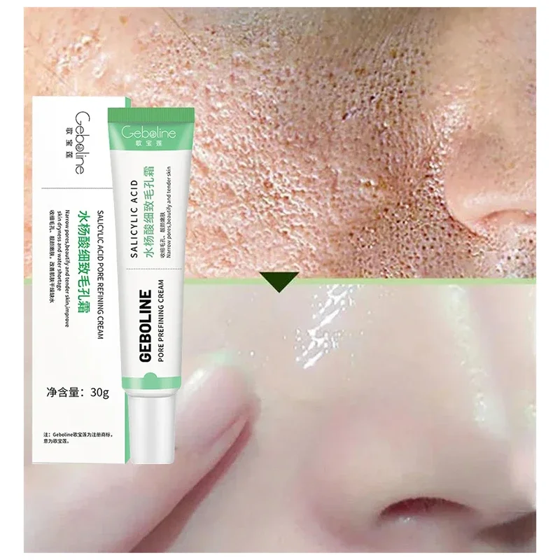 Salicylzuur Porie Krimpende Cr - Collagen Peptide Powder recensie en prijs